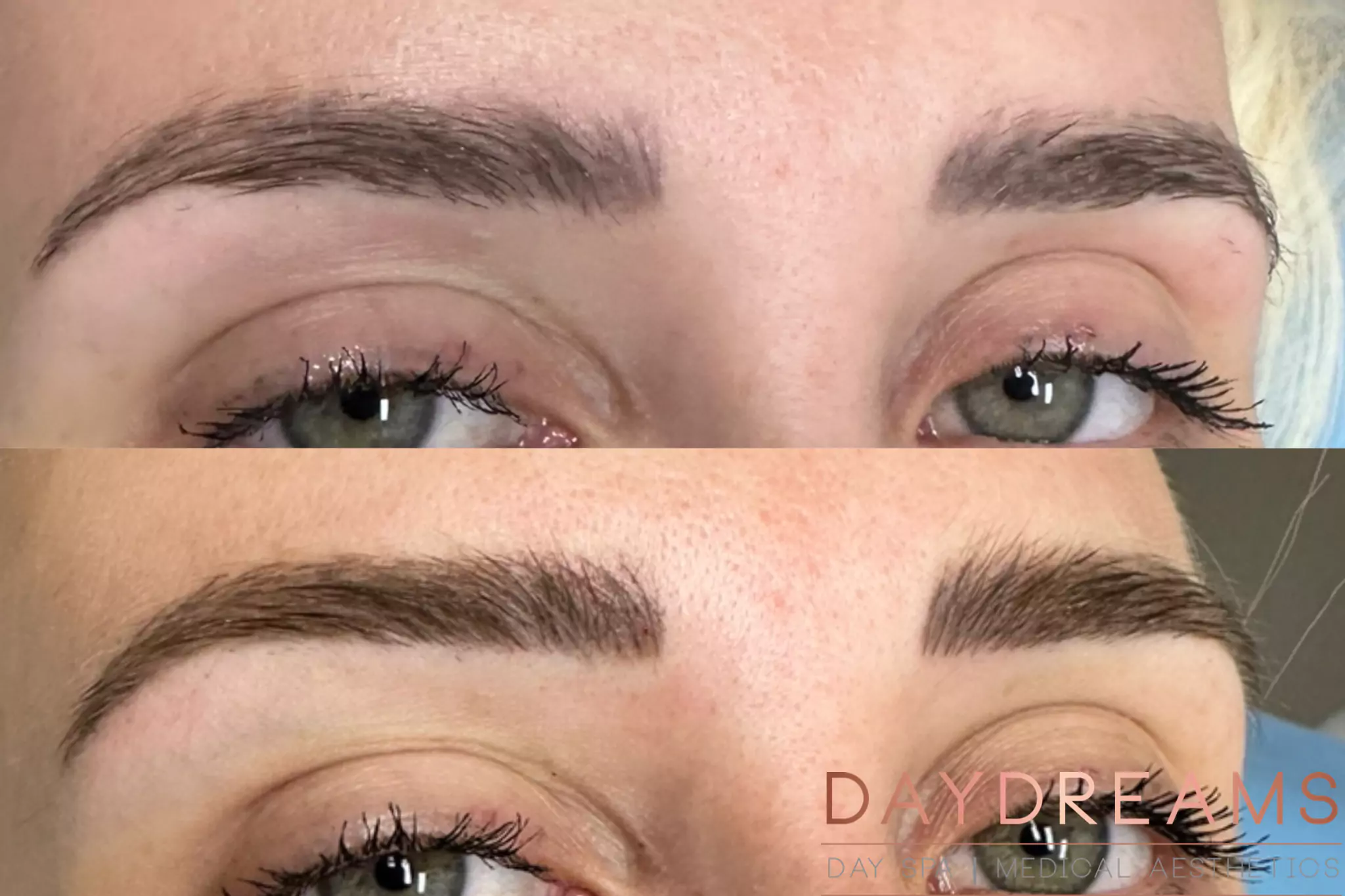 Microblading before-after image 2